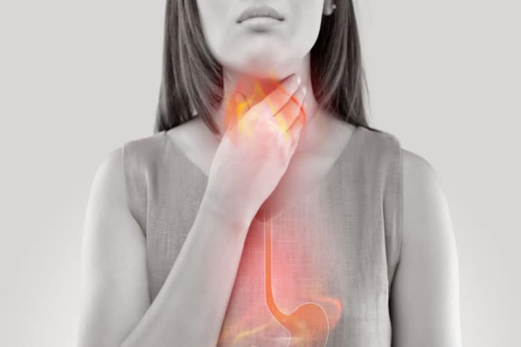 What Triggers Acid Reflux?